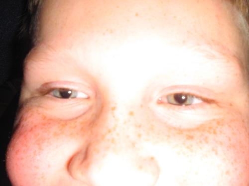 Original image